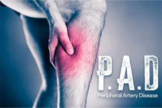 Peripheral Artery Disease